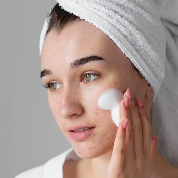 Zero Skin Zero Skin Acne Care Collection Box - Klärendes Pflegeset gegen Unreinheiten & Rötungen - 195 ml – Produktbild 3 von 4