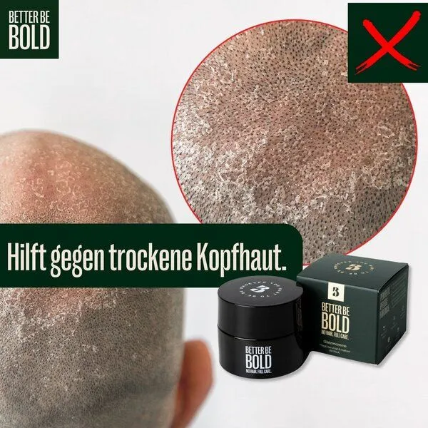 BETTER BE BOLD BETTER BE BOLD – Bio Glatzencreme mit Anti-Shine-Effekt (50 ml) – Produktbild 3 von 4
