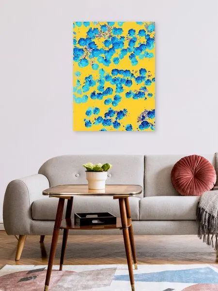 Photocircle Photocircle Poster / Leinwandbild - Bananans & Blue – Produktbild 2 von 4